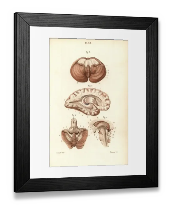 Framed Print : Sections through the brain, cerebellum and ventricles Framed Print : Sections through the brain, cerebellum and ventricles