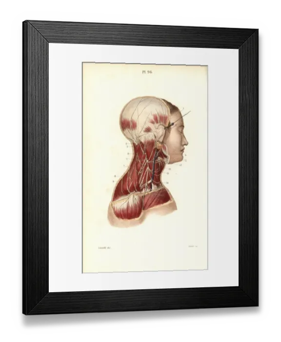 Framed Print : Cervical plexus Framed Print : Cervical plexus