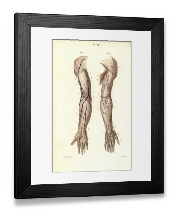 Framed Print : Nerves to the arm and hand Framed Print : Nerves to the arm and hand