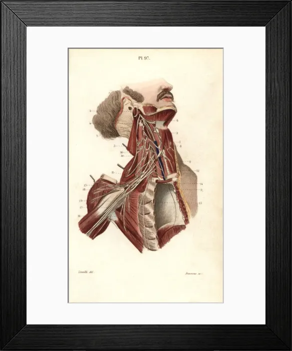 Framed Print : Brachial plexus Framed Print : Brachial plexus