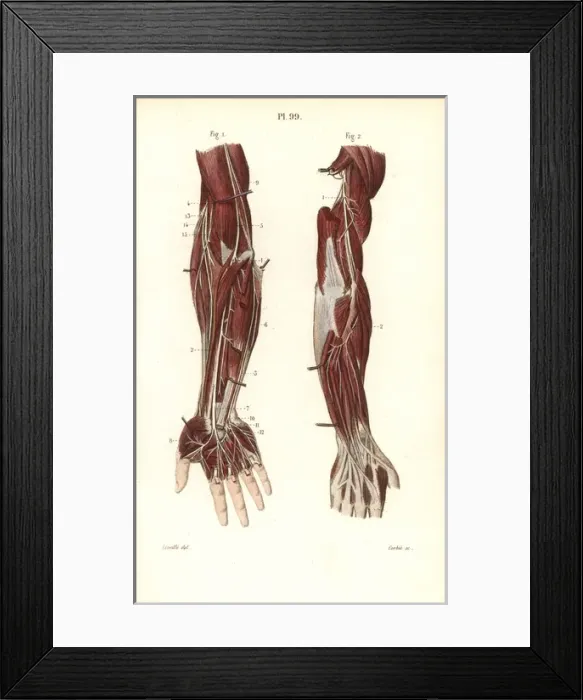 Framed Print : Deep nervous system to the arm and hand Framed Print : Deep nervous system to the arm and hand