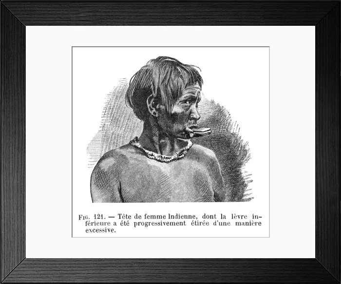 Framed Print : Body Deformation / Lips Framed Print : Body Deformation / Lips