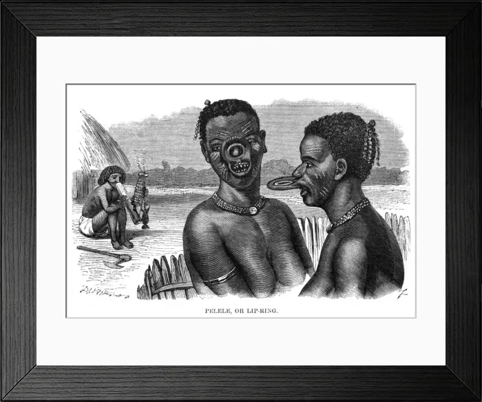 Framed Print : Body Deformation / Lips Framed Print : Body Deformation / Lips