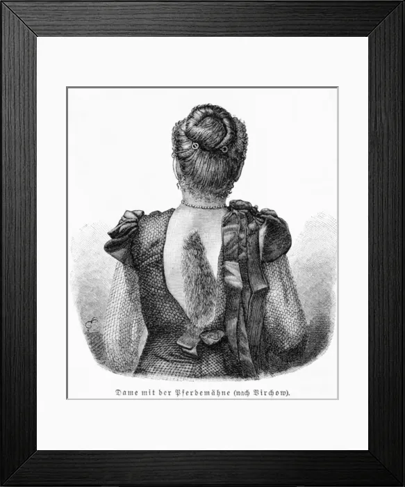 Framed Print : Hair on Back Framed Print : Hair on Back