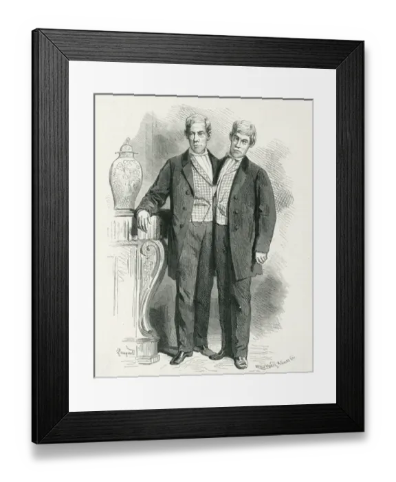 Framed Print : Eng and Chang, Siamese twins Framed Print : Eng and Chang, Siamese twins