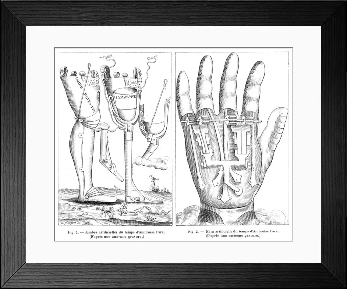 Framed Print : Artificial Limbs, France 16th Century Framed Print : Artificial Limbs, France 16th Century