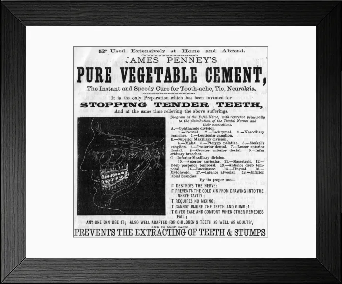 Framed Print : Dental advert, Pure Vegetable Cement Framed Print : Dental advert, Pure Vegetable Cement