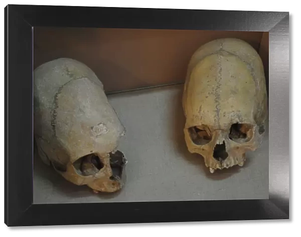Sarmatians. Deformed human skulls. Probably dated in the 3rd
