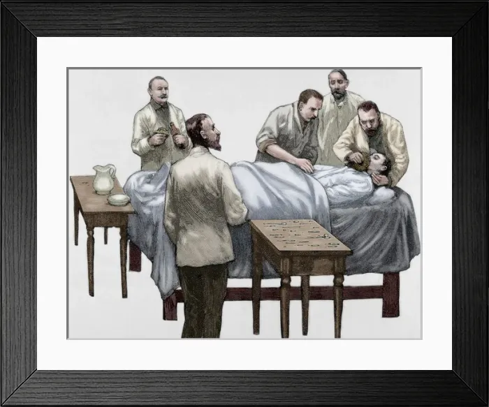 Framed Print : History of medicine. Chloroform anesthesia. Engraving, 19th Framed Print : History of medicine. Chloroform anesthesia. Engraving, 19th
