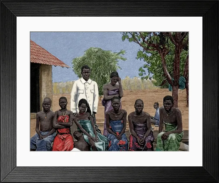 Framed Print : Africa. Native affected by sleeping sickness. Engraving by T Framed Print : Africa. Native affected by sleeping sickness. Engraving by T