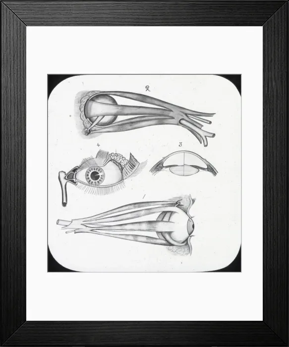 Framed Print : X-Ray - Sight - muscles of eye and Lachmymal apparatus Framed Print : X-Ray - Sight - muscles of eye and Lachmymal apparatus