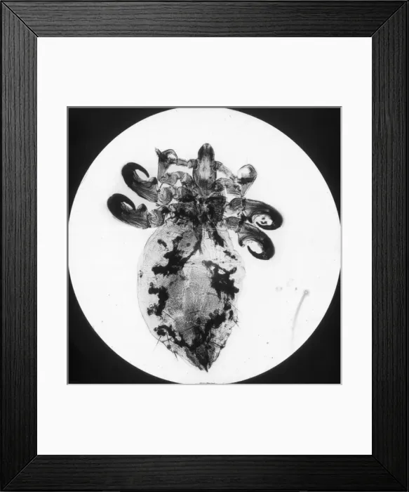Framed Print : X-Ray - Antelope Parasite Framed Print : X-Ray - Antelope Parasite
