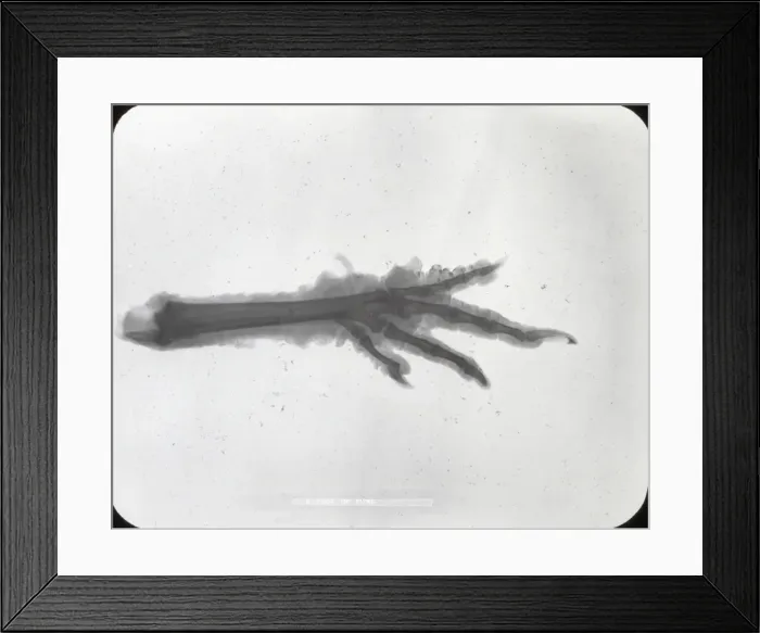 Framed Print : X-Ray - Claw foot Framed Print : X-Ray - Claw foot