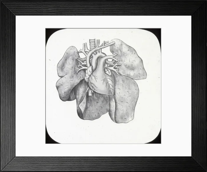 Framed Print : X-Ray - Heart and Lungs Framed Print : X-Ray - Heart and Lungs
