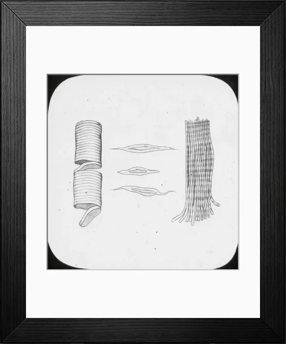 Framed Print : X-Ray - Voluntary and Involuntary Muscular Fibres Framed Print : X-Ray - Voluntary and Involuntary Muscular Fibres