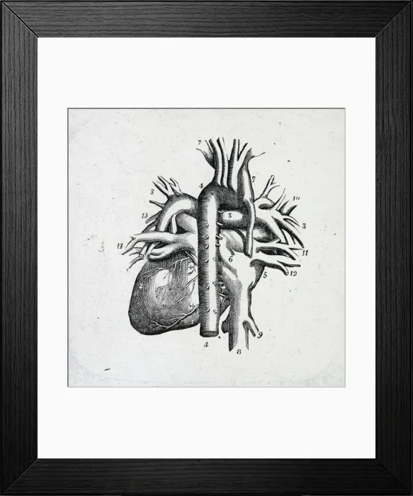 Framed Print : X-Ray - Heart and Vessels Framed Print : X-Ray - Heart and Vessels