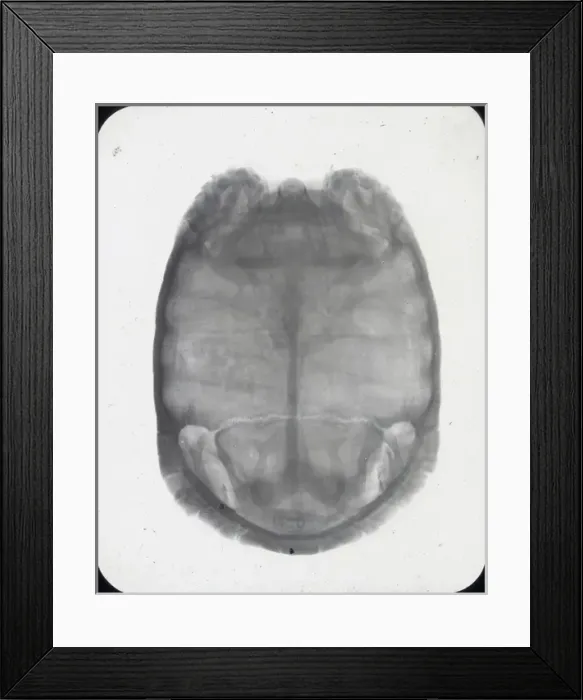 Framed Print : X-Ray - Showing Skeleton of Tortoise Framed Print : X-Ray - Showing Skeleton of Tortoise