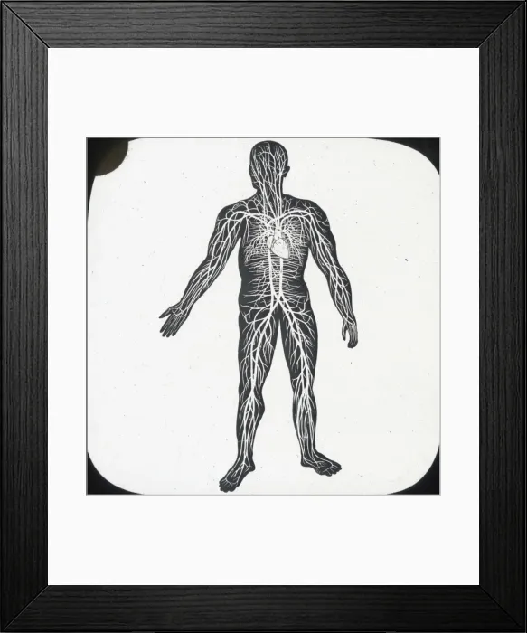 Framed Print : X-Ray - Circulatory System of Human Framed Print : X-Ray - Circulatory System of Human