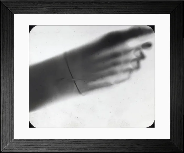 Framed Print : X-Ray - Human Foot Framed Print : X-Ray - Human Foot