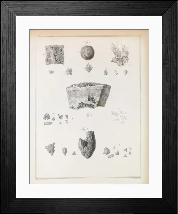 Framed Print : Urinary stones Framed Print : Urinary stones