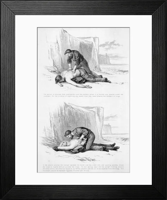 Framed Print : ACCIDENTS / LIFE-SAVING Framed Print : ACCIDENTS / LIFE-SAVING