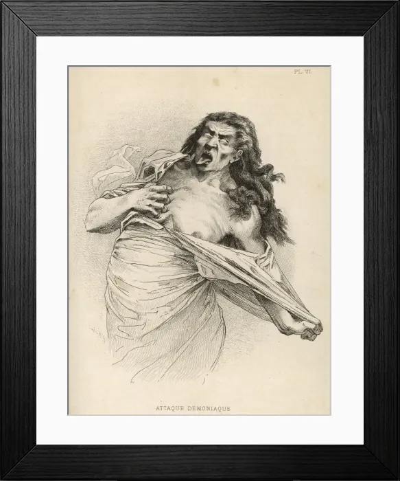 Framed Print : INSANITY HYSTERIA 1881 Framed Print : INSANITY HYSTERIA 1881