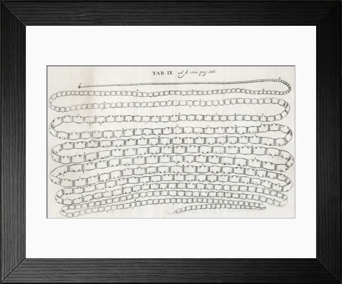 Framed Print : LONG WORM. A tapeworm taken from a patient in Paris by Dr Nicolas ?Antry Framed Print : LONG WORM. A tapeworm taken from a patient in Paris by Dr Nicolas ?Antry
