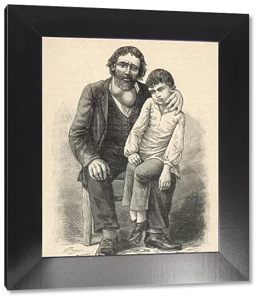 MAN WITH GOITRE AND SON