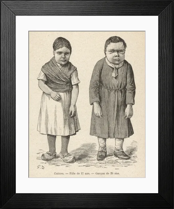 Framed Print : TWO CRETINS Framed Print : TWO CRETINS