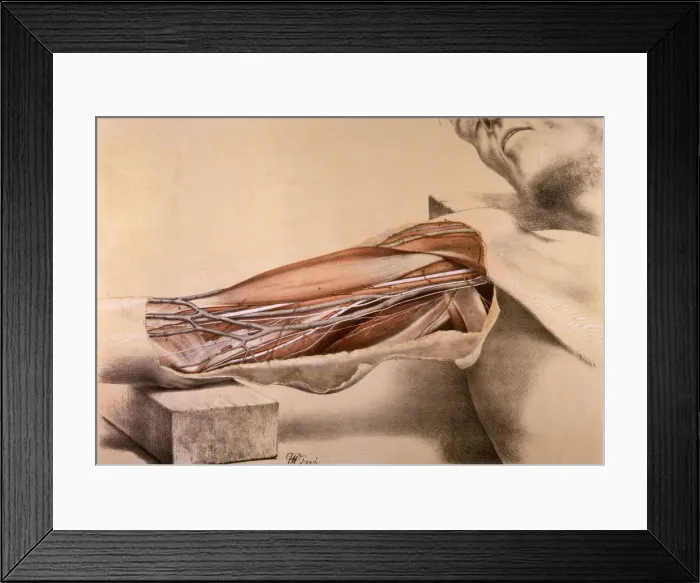 Framed Print : Anatomy, inner arm dissection post-mortem Framed Print : Anatomy, inner arm dissection post-mortem