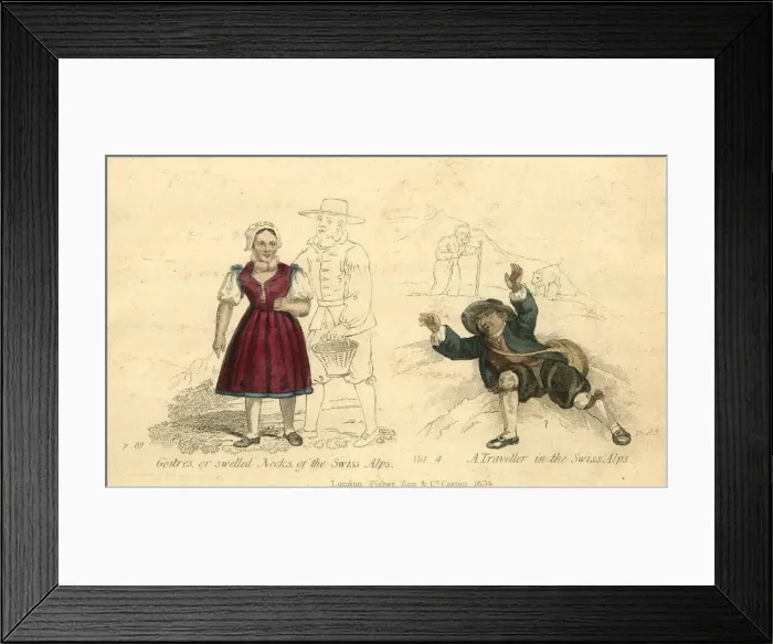 Framed Print : Woman with Goitres, Traveller in Swiss Alps Framed Print : Woman with Goitres, Traveller in Swiss Alps