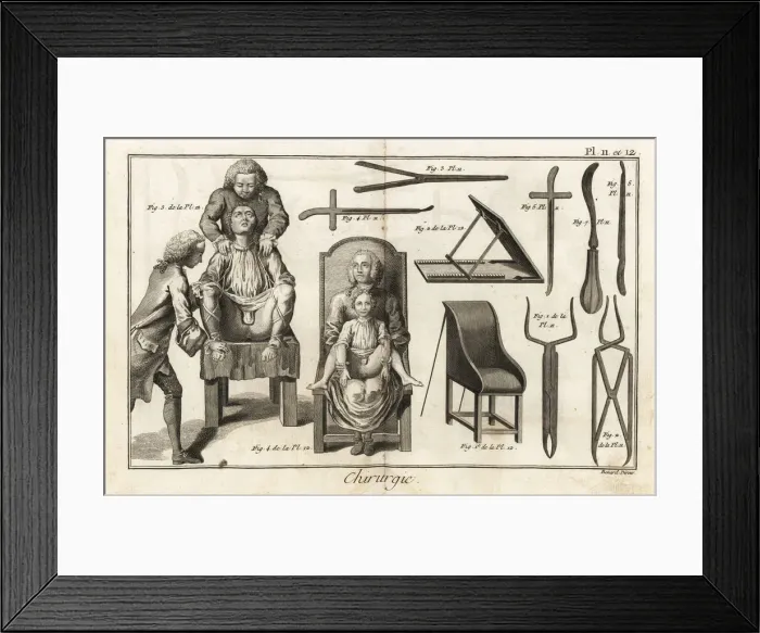 Framed Print : Surgical chairs and instruments for a bladder Framed Print : Surgical chairs and instruments for a bladder