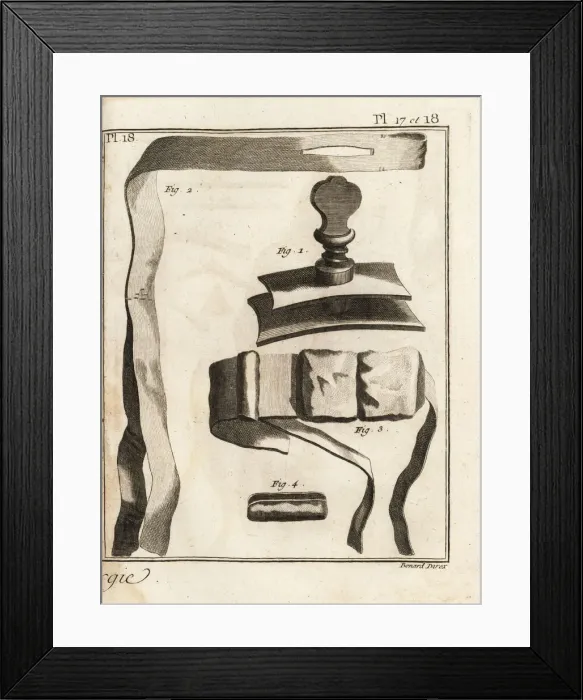 Framed Print : 18th century surgeon Jean Louis Petits screw-type Framed Print : 18th century surgeon Jean Louis Petits screw-type