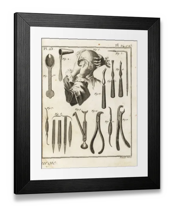 Framed Print : 18th century lacrimal gland operation and surgical equipment Framed Print : 18th century lacrimal gland operation and surgical equipment