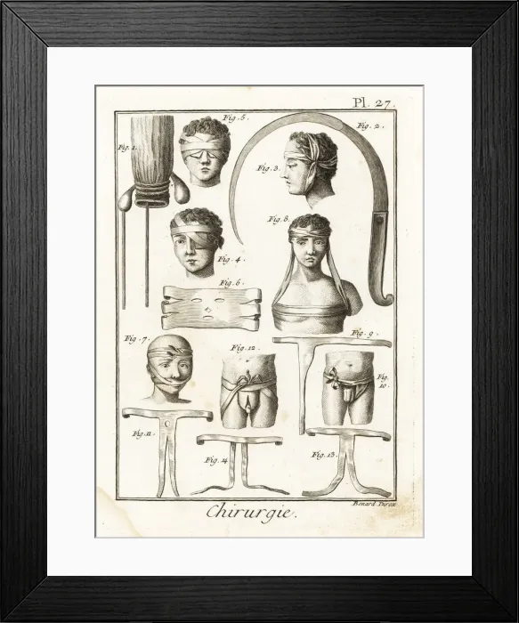 Framed Print : 18th century surgical equipment Framed Print : 18th century surgical equipment