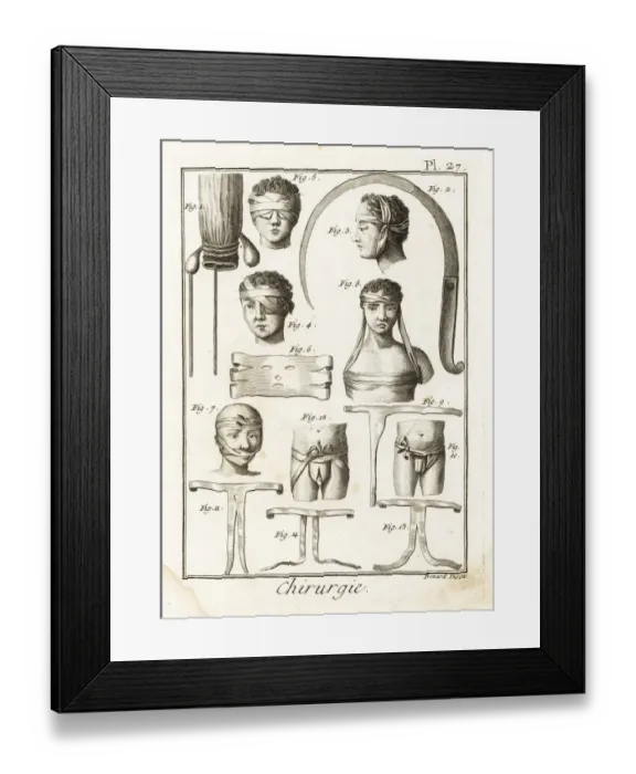 Framed Print : 18th century surgical equipment Framed Print : 18th century surgical equipment