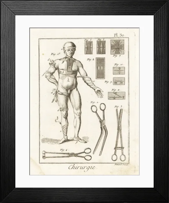 Framed Print : Examples of 18th century bandages, tongs and sutures Framed Print : Examples of 18th century bandages, tongs and sutures