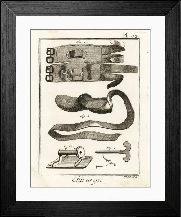 Framed Print : 18th century knee pad 1, slipper 2, winch 3 and key 4 Framed Print : 18th century knee pad 1, slipper 2, winch 3 and key 4
