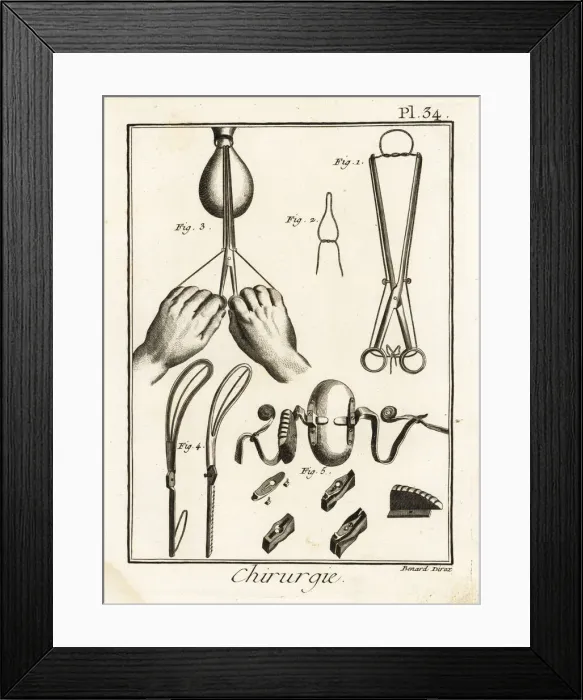 Framed Print : 18th century tweezers and speculum for obstetrics Framed Print : 18th century tweezers and speculum for obstetrics
