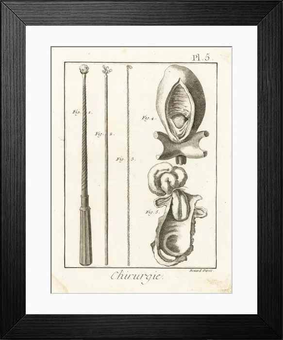 Framed Print : Surgical instruments to remove foreign bodies Framed Print : Surgical instruments to remove foreign bodies