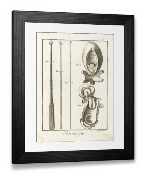 Framed Print : Surgical instruments to remove foreign bodies Framed Print : Surgical instruments to remove foreign bodies