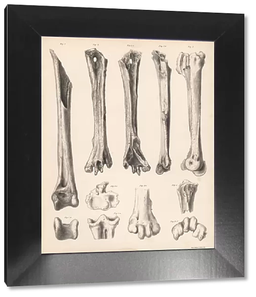 Tibia and metatarsus of the extinct Rodrigues