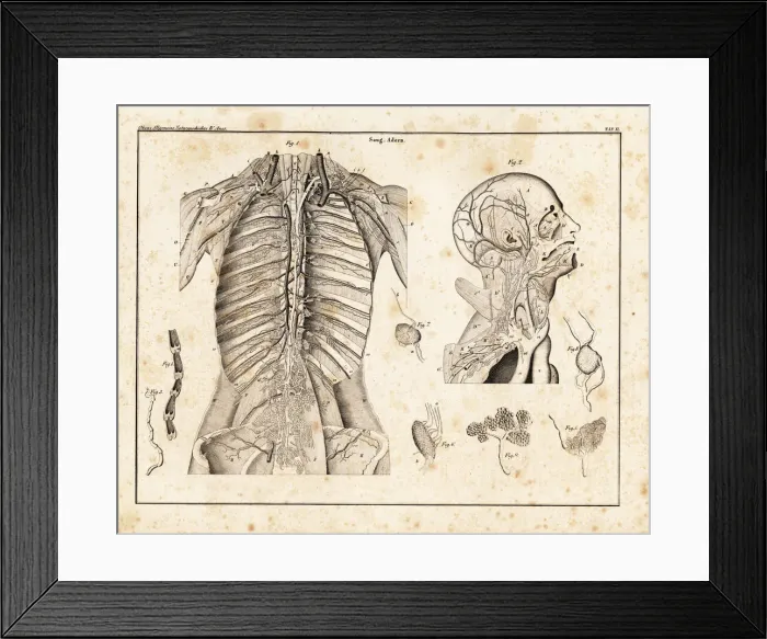 Framed Print : Anatomy of human venous return system in the upper torso Framed Print : Anatomy of human venous return system in the upper torso