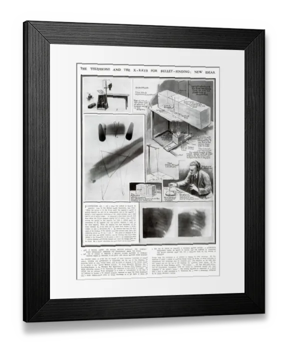 Framed Print : New Ideas for using X-Rays for Medical use WWI Framed Print : New Ideas for using X-Rays for Medical use WWI