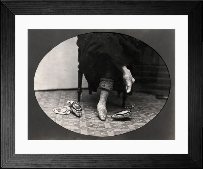 Framed Print : Chinese woman with bound feeet, China, 19th century Framed Print : Chinese woman with bound feeet, China, 19th century