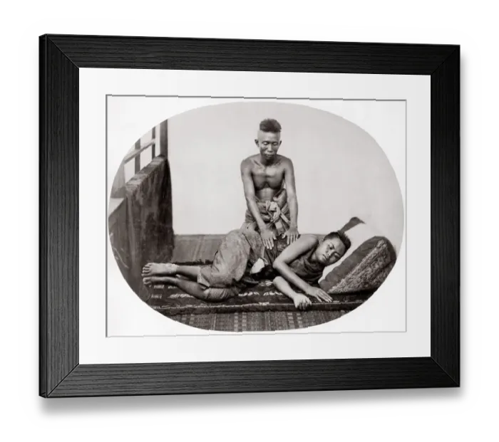 Framed Print : Masseur and massage, probably Siam, Thailand