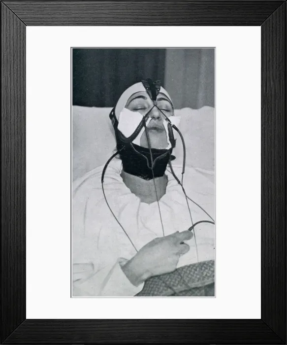 Framed Print : Apparatus for the Removal of the Double Chin 1927 Framed Print : Apparatus for the Removal of the Double Chin 1927