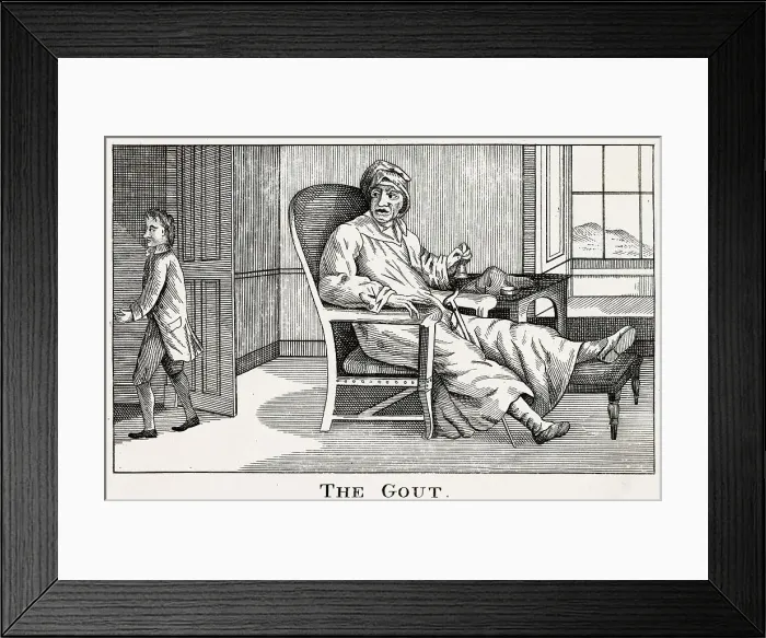 Framed Print : A gouty invalid angrily rings for his manservant, presumably to fetch him some more port! Date: 18th century Framed Print : A gouty invalid angrily rings for his manservant, presumably to fetch him some more port! Date: 18th century