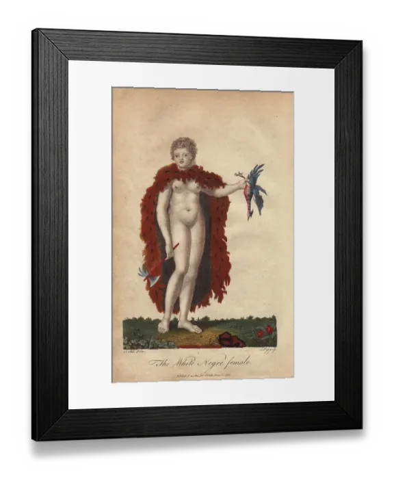Framed Print : African albino woman wearing an animal skin Framed Print : African albino woman wearing an animal skin