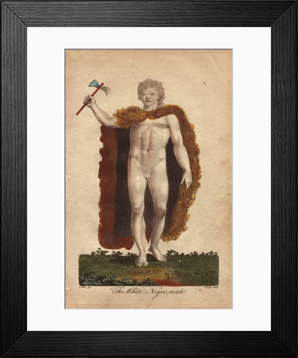 Framed Print : African albino man wearing an animal skin Framed Print : African albino man wearing an animal skin
